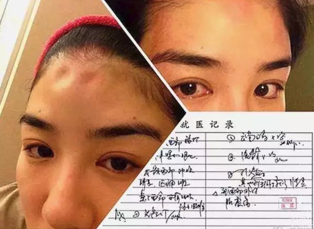 黃毅清吸毒被捕：黃奕，你為何會遇見這樣的渣男？