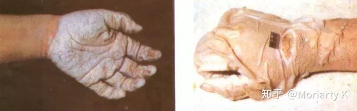 犯罪心理學(xué)：水塘中的碎腐之尸，是受害者亦是施暴者