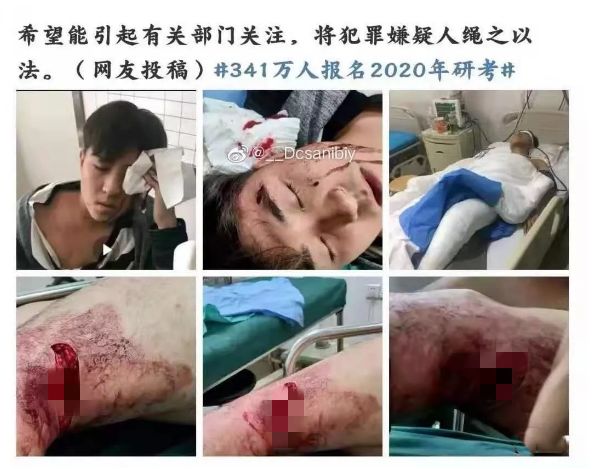 沈陽(yáng)研究生砍人事件：這三件事，一定要讓孩子知道