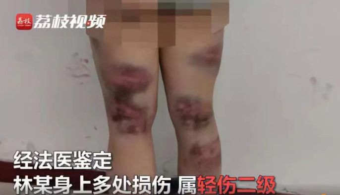 大齡未婚女青年會(huì)被歧視嗎？