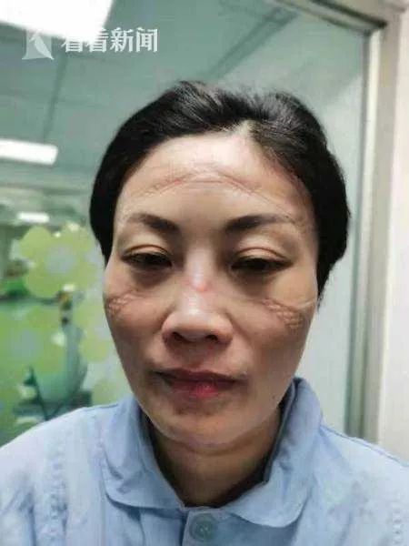 確診老人隱瞞致百余人密切接觸：比病毒更可怕的，是人心
