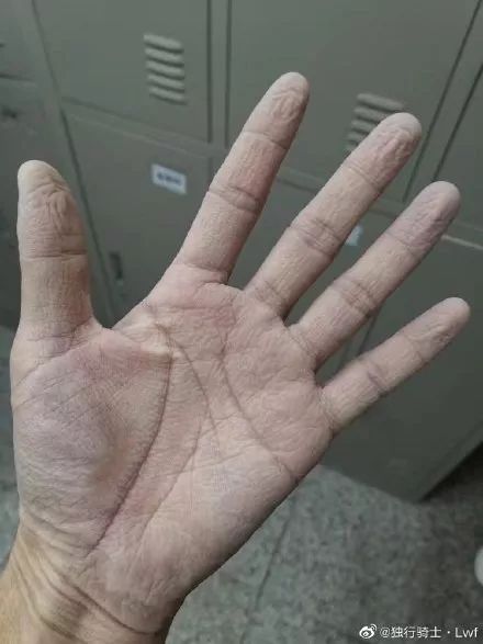 確診老人隱瞞致百余人密切接觸：比病毒更可怕的，是人心