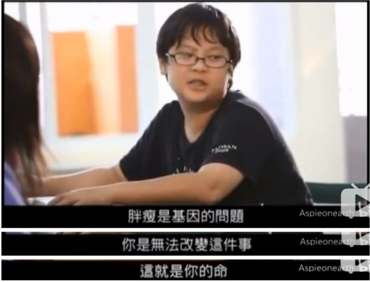 不合群的天才病、阿斯伯格癥