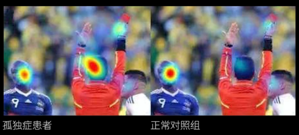 眼動(dòng)地形圖、早期鑒別孤獨(dú)癥孩子的重大發(fā)現(xiàn)