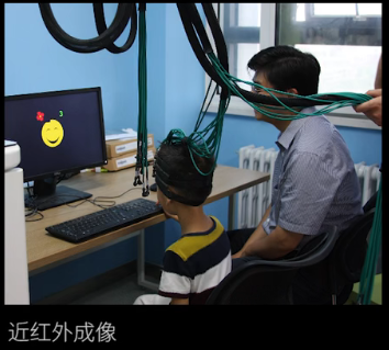 眼動(dòng)地形圖、早期鑒別孤獨(dú)癥孩子的重大發(fā)現(xiàn)