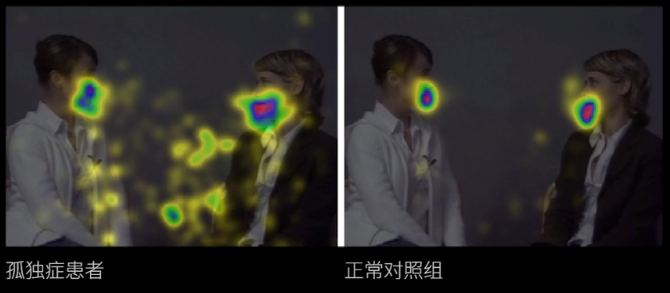 眼動(dòng)地形圖、早期鑒別孤獨(dú)癥孩子的重大發(fā)現(xiàn)