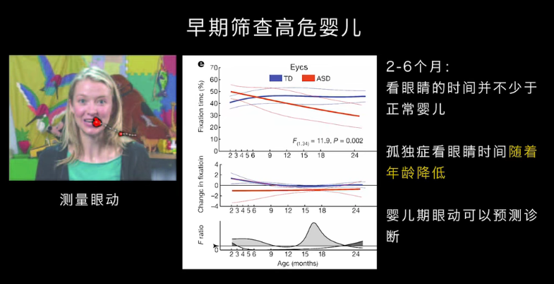 眼動(dòng)地形圖、早期鑒別孤獨(dú)癥孩子的重大發(fā)現(xiàn)