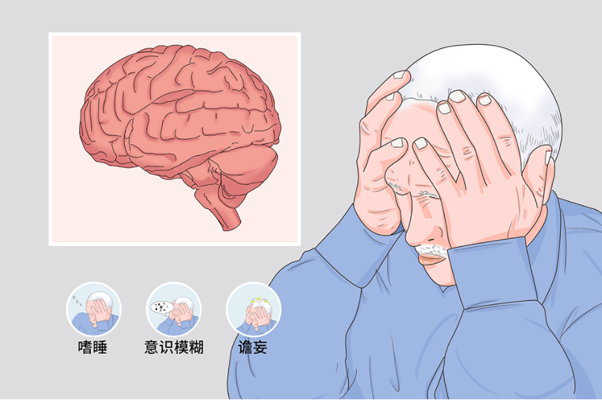 簡述意識障礙的分類及表現(xiàn) 意識障礙是什么